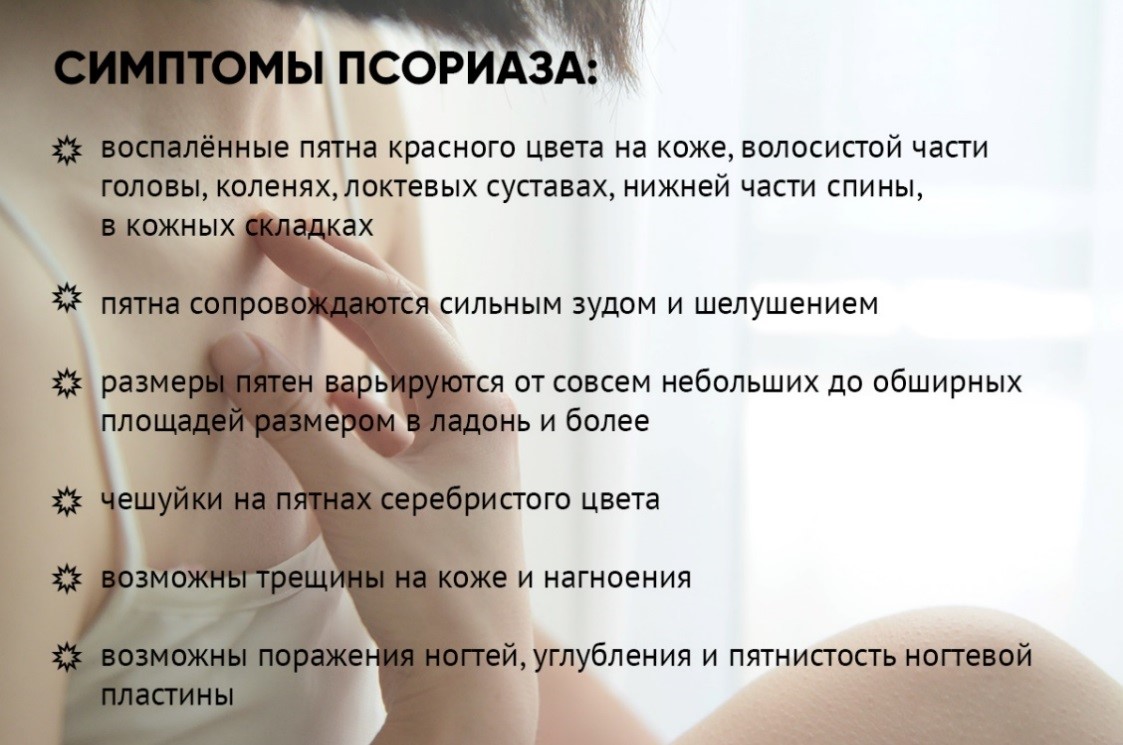 psoriaz
